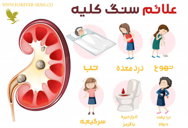 علائم سنگ کلیه چیست